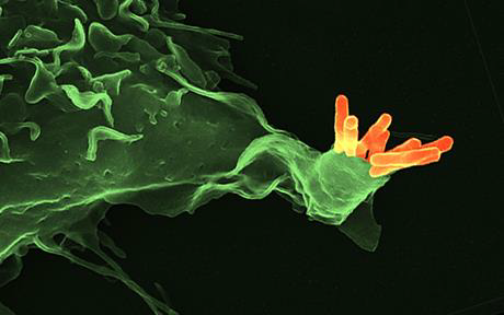 Mycobacterium tuberculosis (naranja) unida a la superficie de una célula humana (verde). Kaufmann S.H.E. Nature. 2008 May 15;453: 295-6. Figura: Volker Brinkmann, Core Facility Microscopy, Max Planck Institute for Infection Biology, Berlin.-